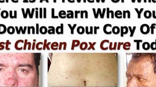 treatment for chicken pox - chicken pox during pregnancy - fast chicken pox cure