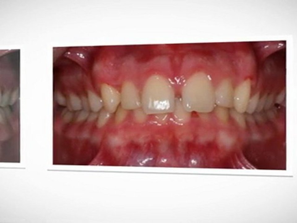 Houston Braces Today