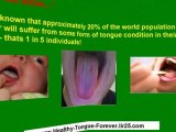 thrush treatments - treatments for thrush - what is thrush in the mouth