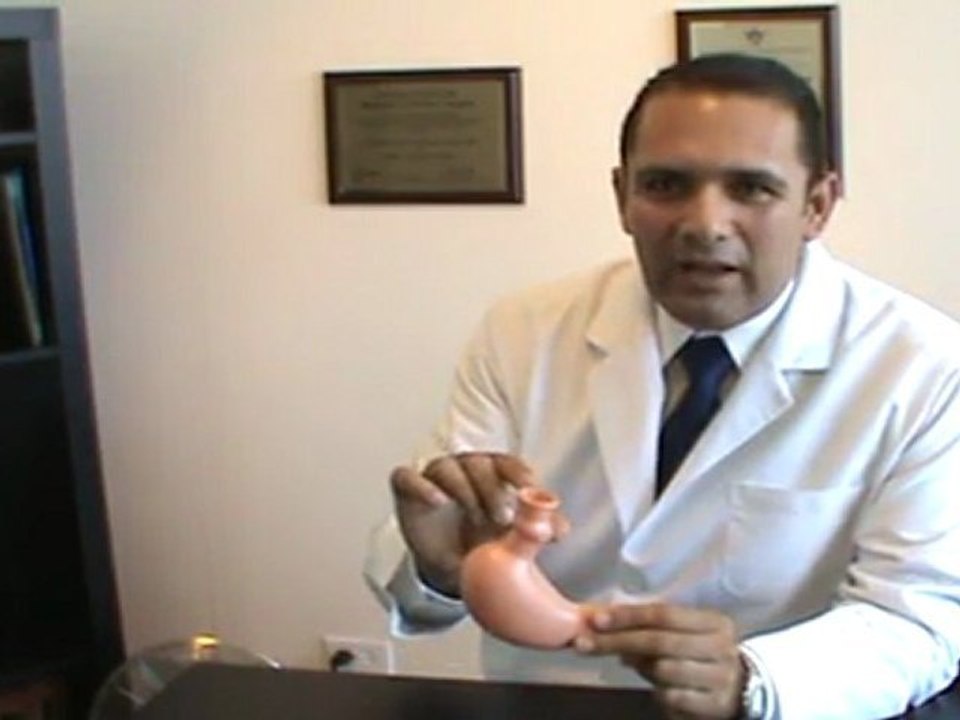 gastric plication1