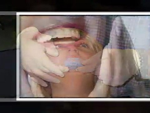 Teeth Whitening Waukegan IL - Tooth Bleaching Waukegan IL - Waukegan IL Cosmetic Dentist