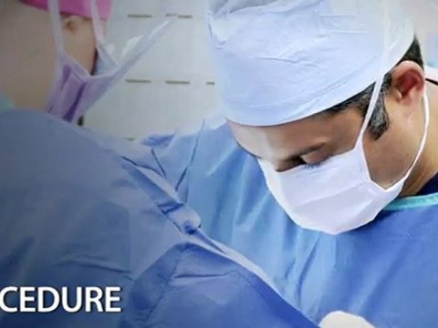 Mommy Makeover Dallas & Plano, Texas – Tummy Tuck Patient