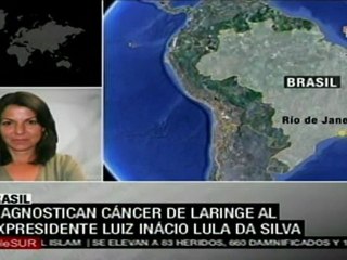 Lula diagnosticado con cáncer de laringe