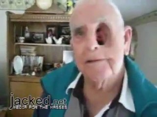 முகத்தில் பாரிய குழி விழுந்த அதிசய மனிதர்! Newyarl.com