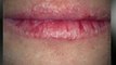 Lip Fusion Reviews | Lip Fusion Lip Plumper Scam