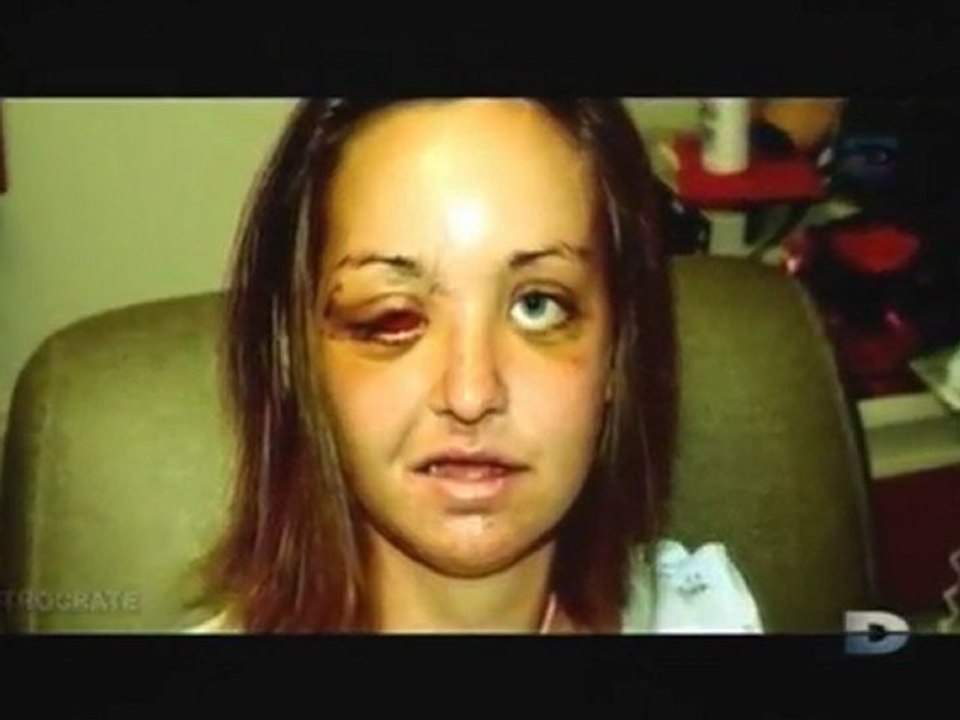 15 incroyables histoires de survie [partie1] - 1 de 3