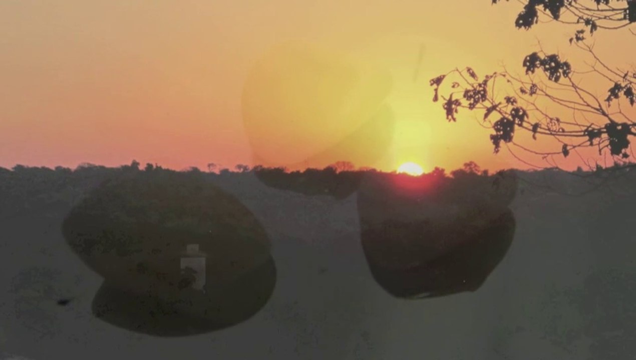 Multiples indications de facettes dentaires en céramique collée.