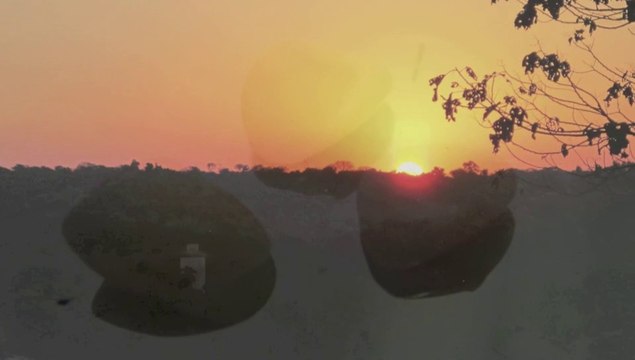 Multiples indications de facettes dentaires en céramique collée.