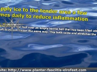 Self-Care For Plantar Fasciitis - Or What Can I Do to Help Myself?