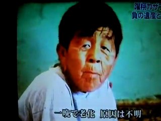 ‪一晩で老化した少年