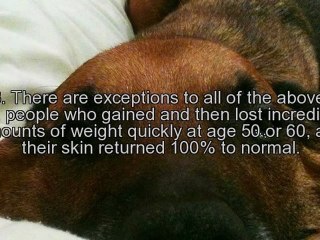 Flabby Loose Skin After Weight Loss