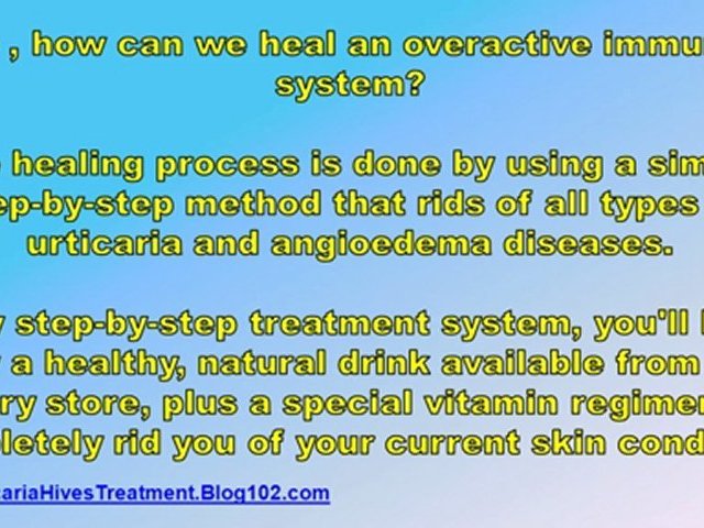 chronic urticaria treatment – treatment of urticaria