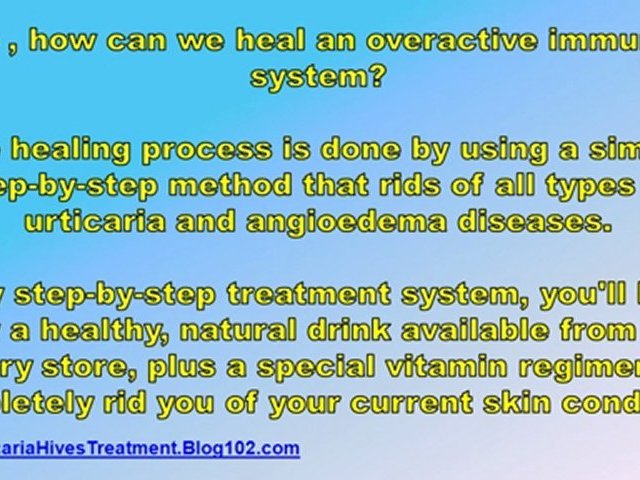 cholinergic urticaria treatment – treatment for urticaria