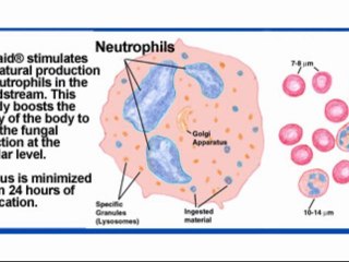 Natural Ways to Treat Pityriasis Rosea