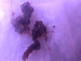 insetto rosso  dendrobates collemboli