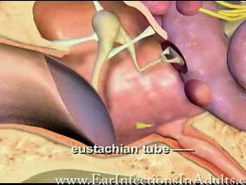 Curing Recurring Ear Infections in Your Child