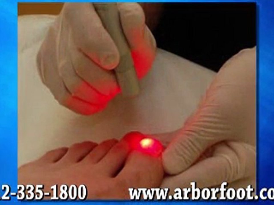 Laser Treatment for Ingrown Toenails - Austin, TX Podiatrist
