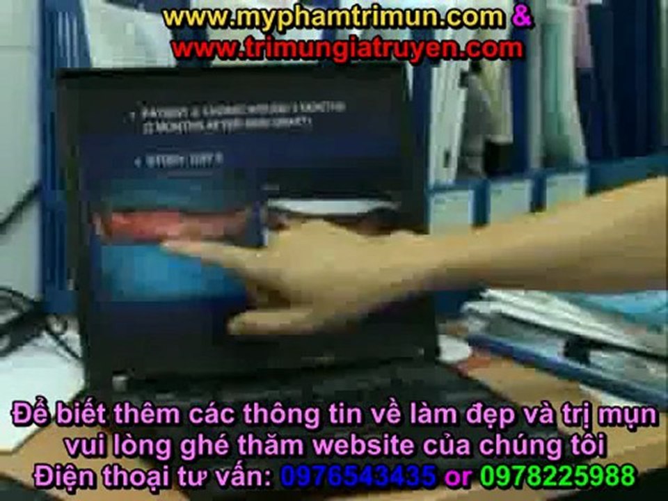 Sinh phẩm làm đẹp từ tế bào gốc (FNC) p3 of 4