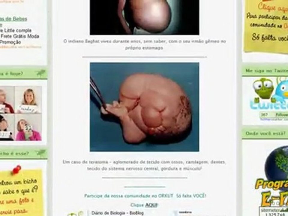 FETUS IN FETU