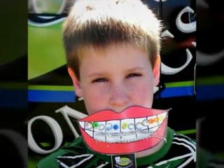 Smile on a Stick - Flowery Branch Orthodontics