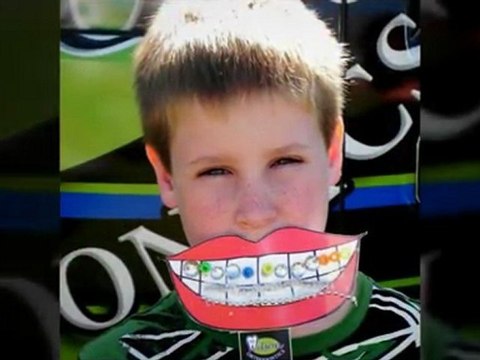 Smile on a Stick - Flowery Branch Orthodontics