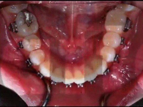 Orthodontist South Austin – Dr. Moody is an Orthodontic Specialist in Austin TX!