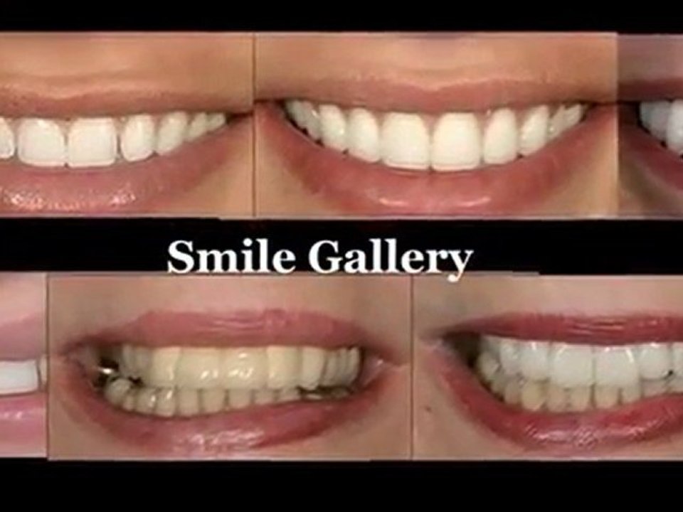 Personalized dental health care procedures and services in Beverley Hills