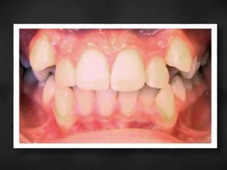 Orthodontist Dallas Nov2011