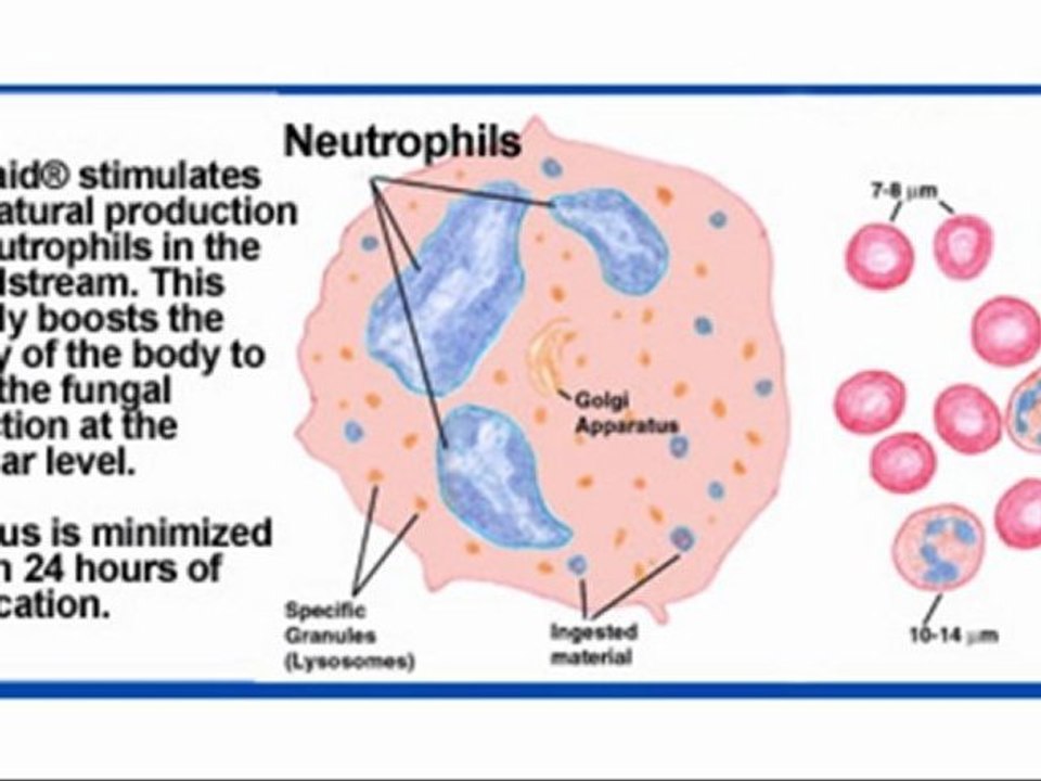 Healing Cellulitis Infection Without Drugs.