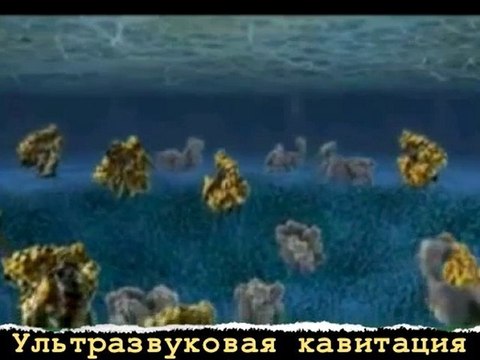 МСК: Кавитация + лимфодренажный массаж