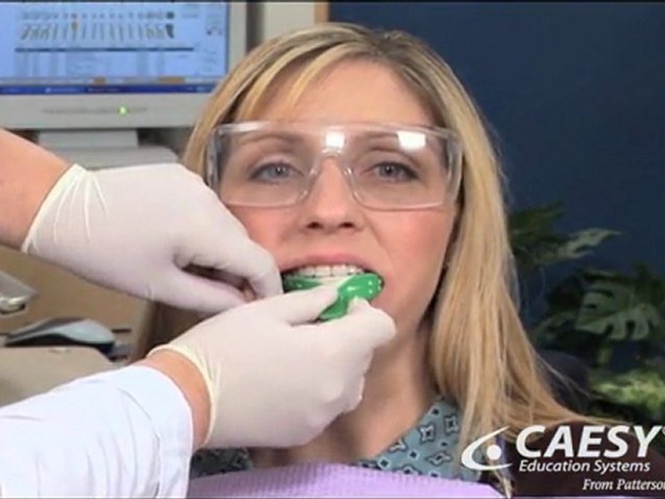 Permanent Teeth Whitening Langhorne, Philadelphia, Newtown