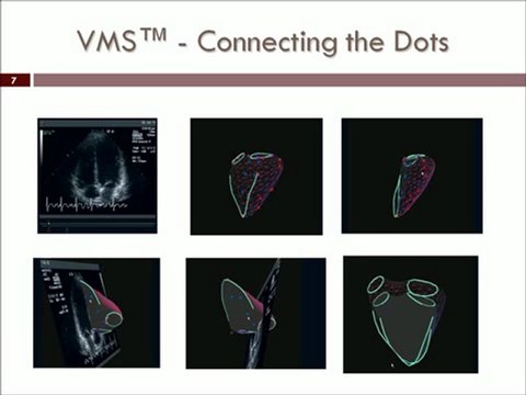 VentriPoint Diagnostics Ltd. (TSX.V: VPT) Opportunity Knocks 2011