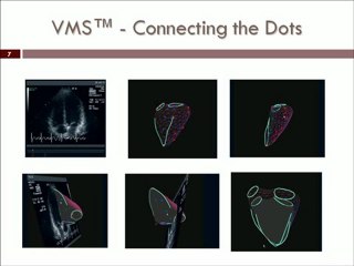VentriPoint Diagnostics Ltd. (TSX.V: VPT) Opportunity Knocks 2011