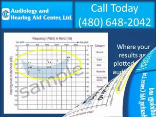 Hearing Loss Effects - Scottsdale AZ