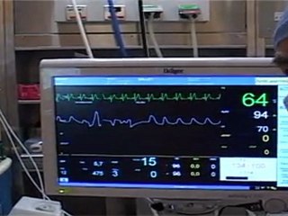 Jean-Jacques Charbonier, anesthésiste sur les NDE