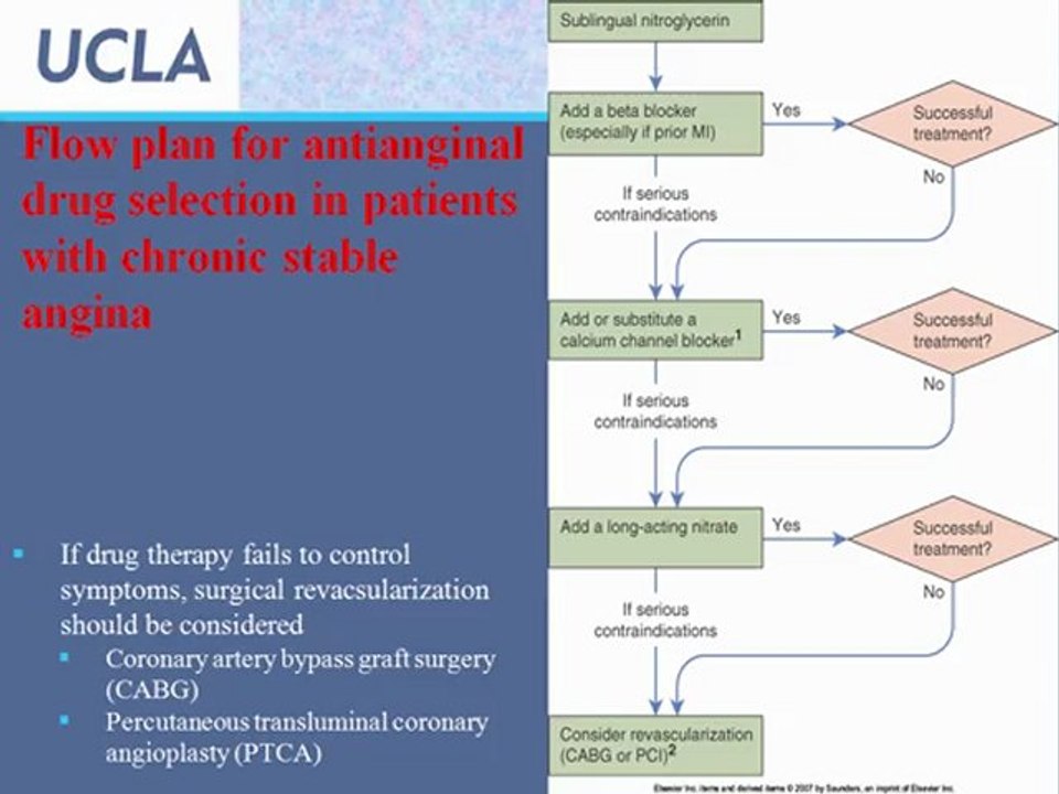 Angina Pectoris