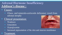 Endocrine Disorders