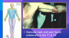 Pain Managment and Opioids (Part 1)