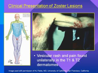 Pain Managment and Opioids (Part 1)