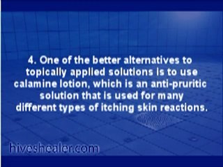 12 remedies for hives