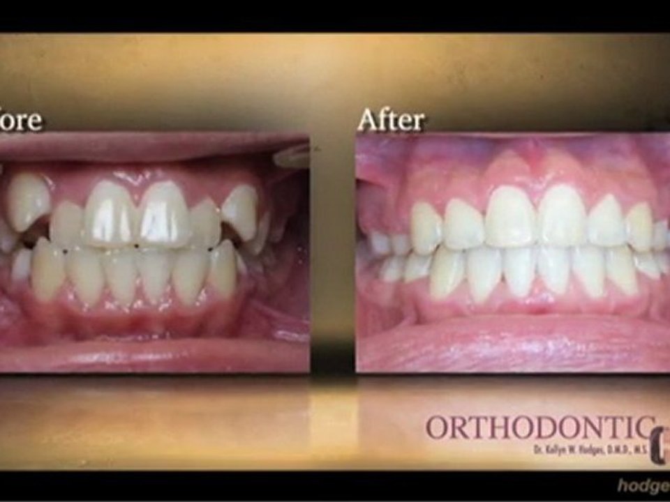 Philadelphia Orthodontist - Dr. Kellyn W. Hodges