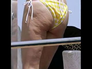 Eliminar Celulitis Rapidamente