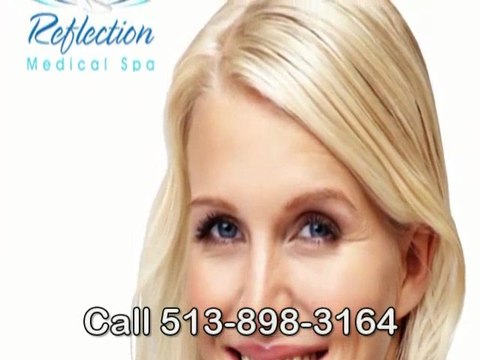 Microdermabrasion Springdale Call 513-898-3164 For ...