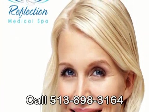 Chemical Peels Glendale Call 513-898-3164 For ...