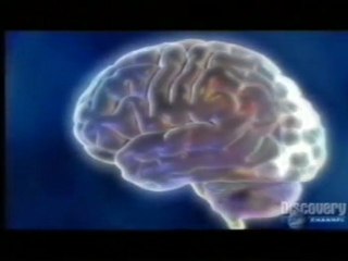 Sindrome de Charles Bonnet: Alucinaciones visuales