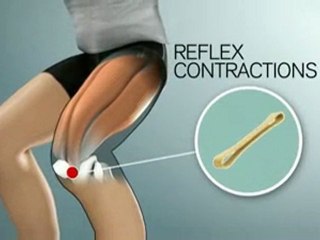 Compex Winplate Plataforma Vibratoria