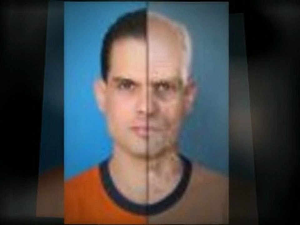 Skincare Products- Anti Aging Wrinkle Cream