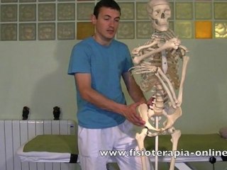 Tendinitis del psoas iliaco. Psoitis.