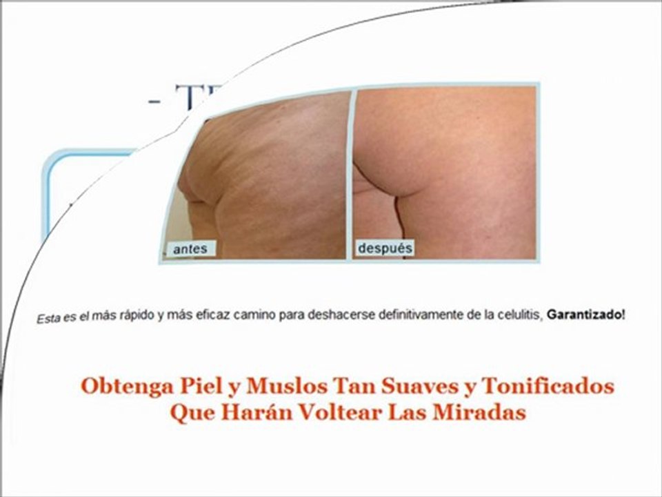 Como Borrar la Celulitis