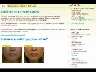 Povecava Ustnic - Estetika Onisak